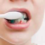 Cara Mengatasi Gusi Berdarah Saat Sikat Gigi Panduan Lengkap Menuju Kesehatan Mulut Optimal